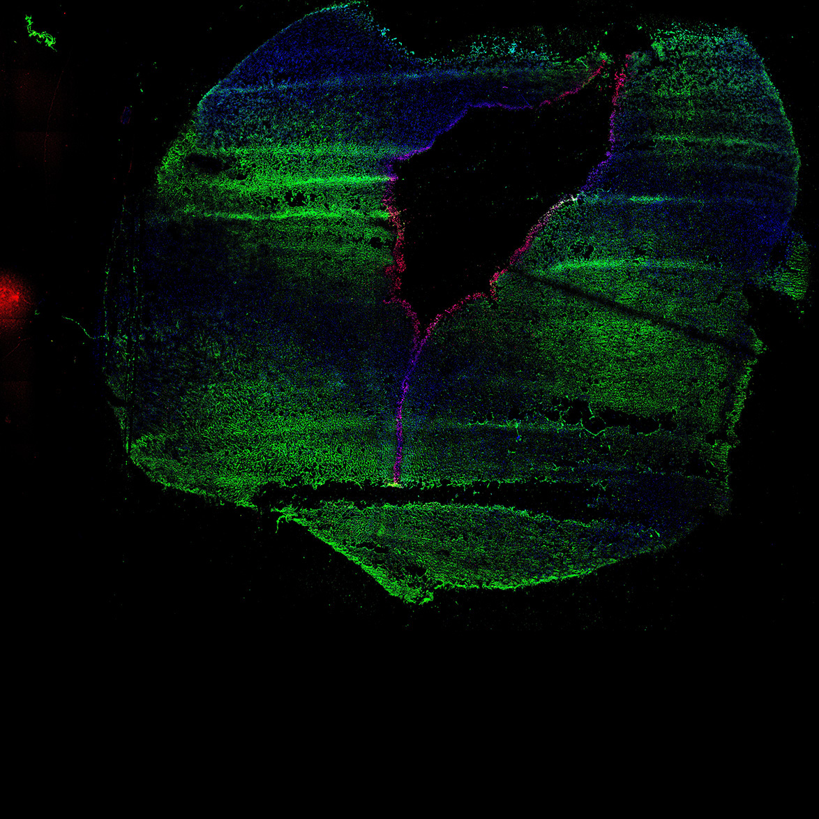 Human foetal midbrain